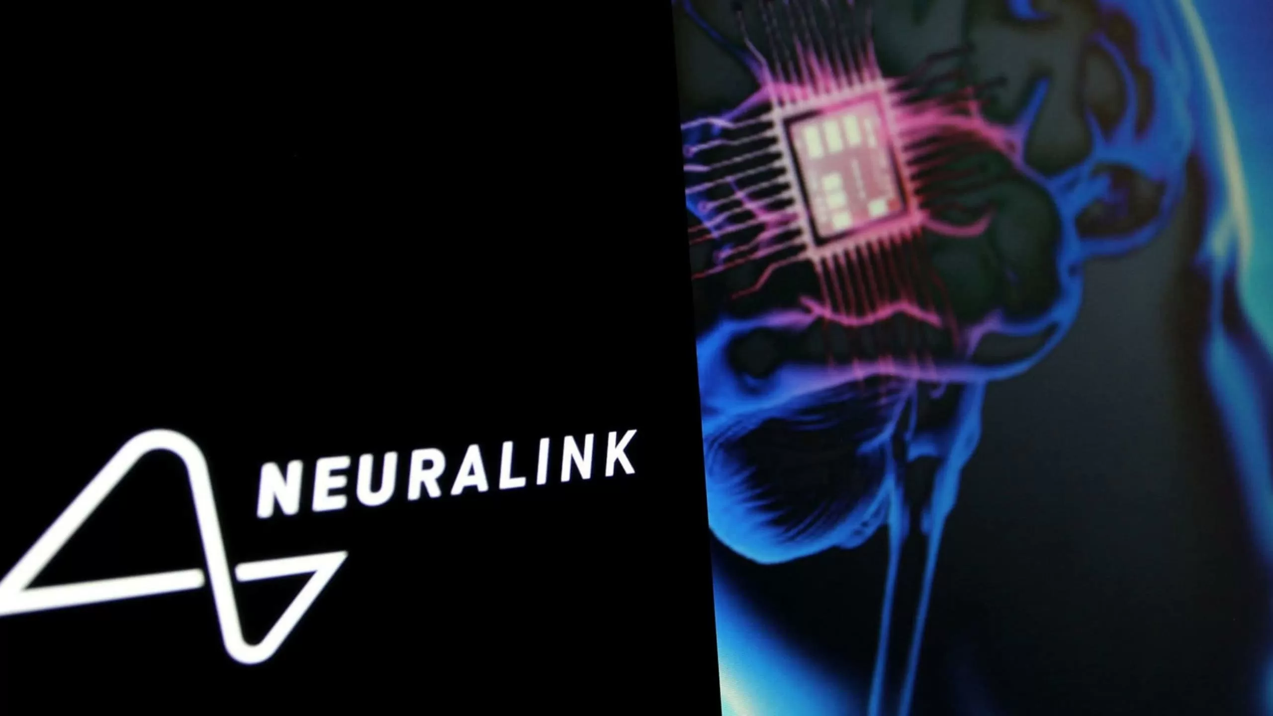 Neuralink: após implante de chip, estudante paraplégico ganhou mais independência