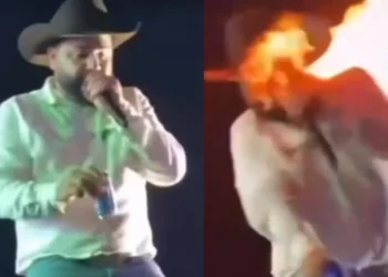 Quem é o cantor sertanejo Leo, que sofreu queimaduras no rosto em show