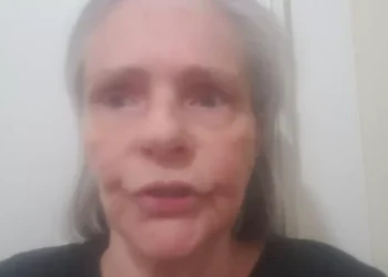 Angela Ro Ro passa por traqueostomia após 19 dias internada no Rio