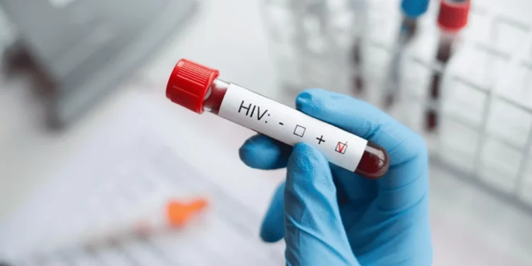 OMS recomenda uso de medicamento para prevenção do HIV